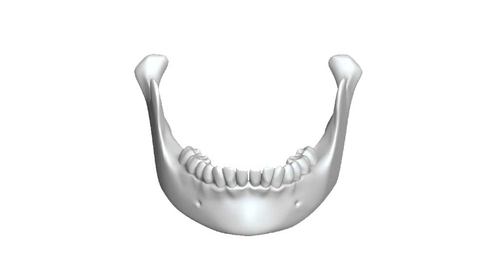 cirugía maxilofacial en madrid centro