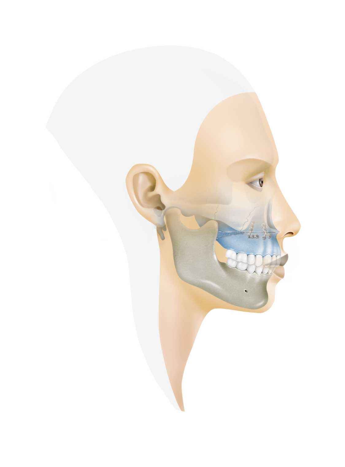 maxilofacial