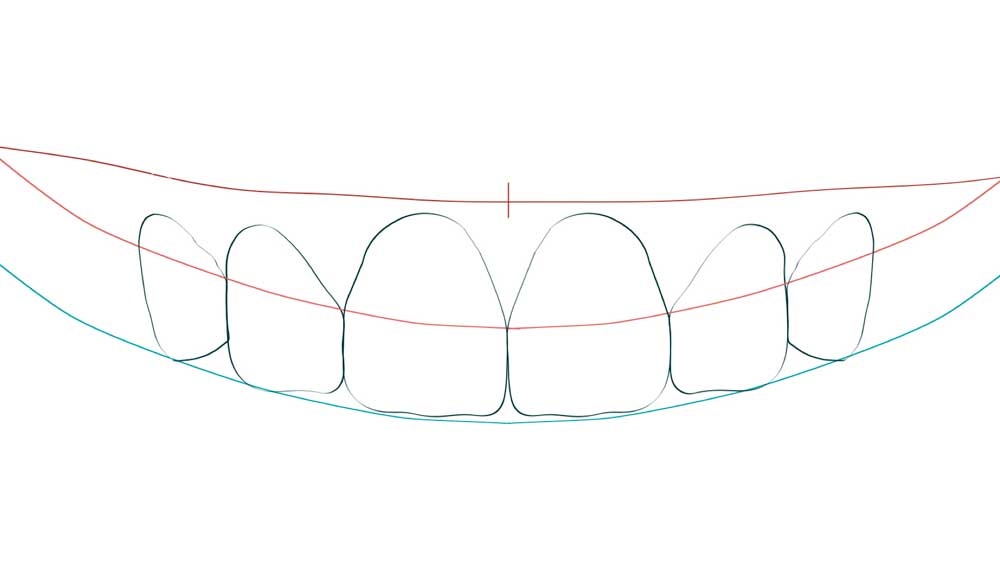 odontología estética en madrid centro