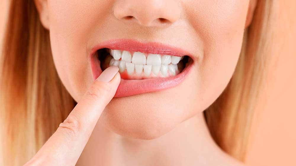 periodoncia madrid centro