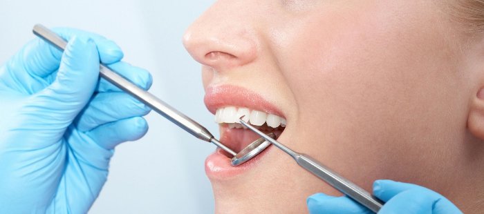 Revisión Dental Después de las Vacaciones: Tu Dentista en Madrid Centro te Cuida