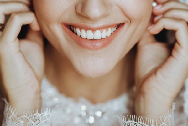 Tratamientos dentales para boda en Madrid Centro: carillas, blanqueamiento dental e Invisalign. Te explicamos en qué consisten